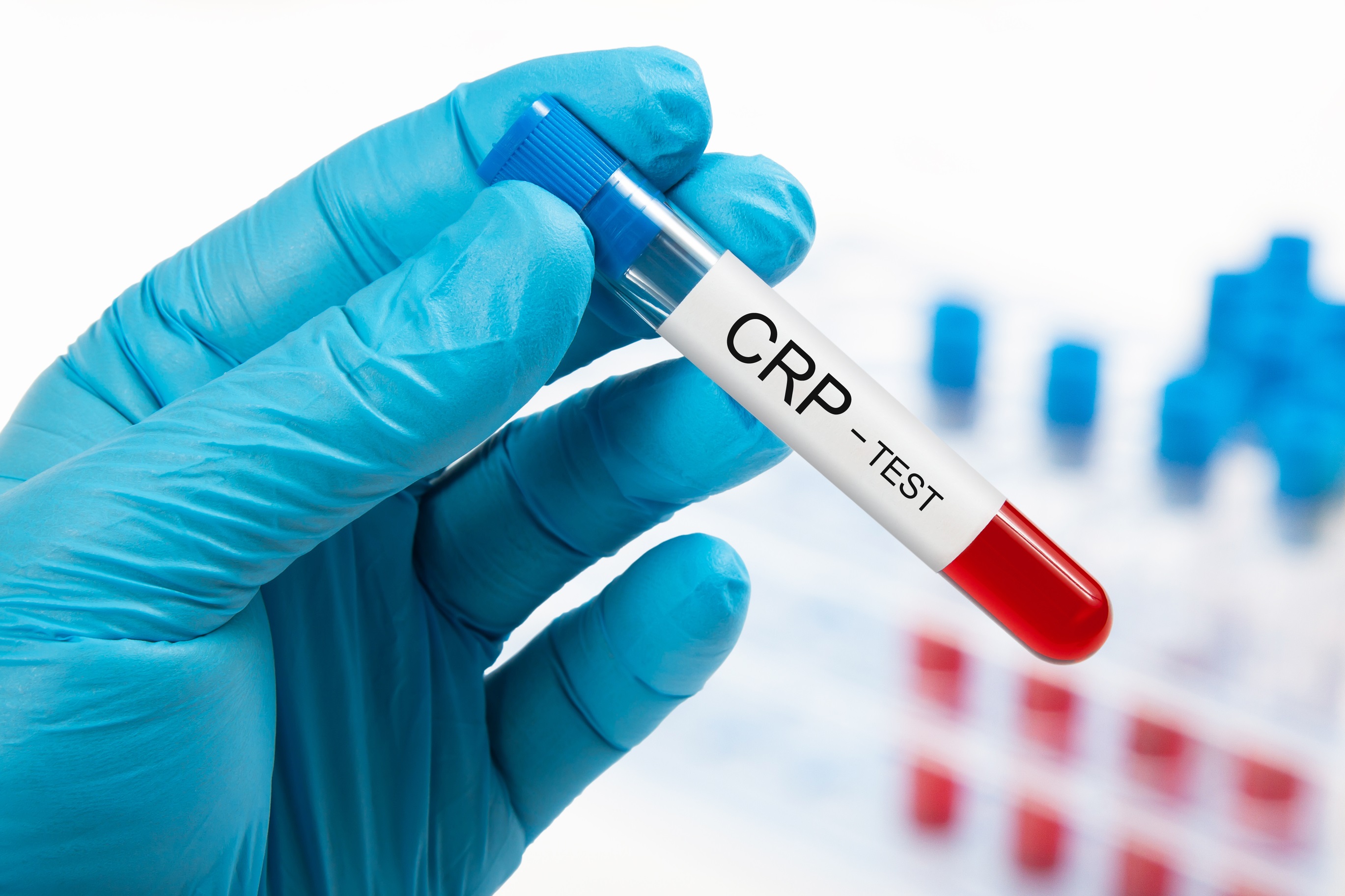 Crp An Indicator Of Current And Future Health Is Greatly Influenced By Several Nutrients Grassrootshealth